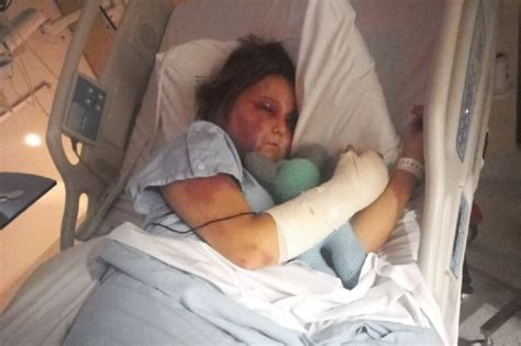 kirra heart after attack|Kirra Harts story: What really happened and latest。